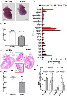 Extracellular matrix and cyclic stretch alter fetal cardiomyocyte proliferation and maturation in a rodent model of heart hypoplasia